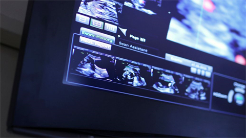 編輯視頻的軟件哪個比較好用 強大的視頻編輯軟件推薦